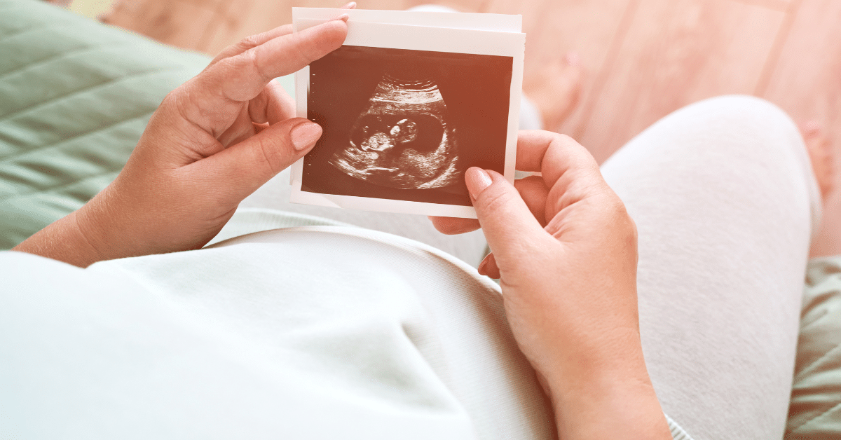 Woman holding ultrasound of 8 week fetus