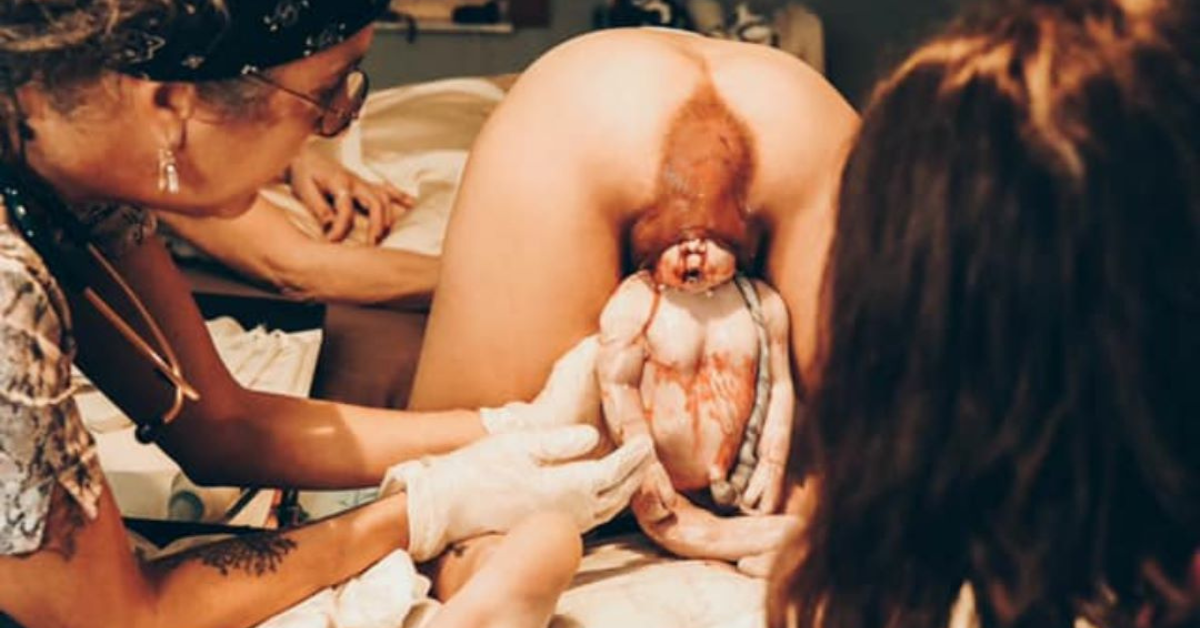 Breech Birth At Home - Midwife360 Fadwah Halaby Certified Nurse Midwife A breech birth at home with Midwife360